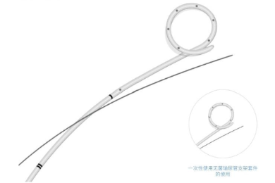 一次性使用无菌输尿管支架套件